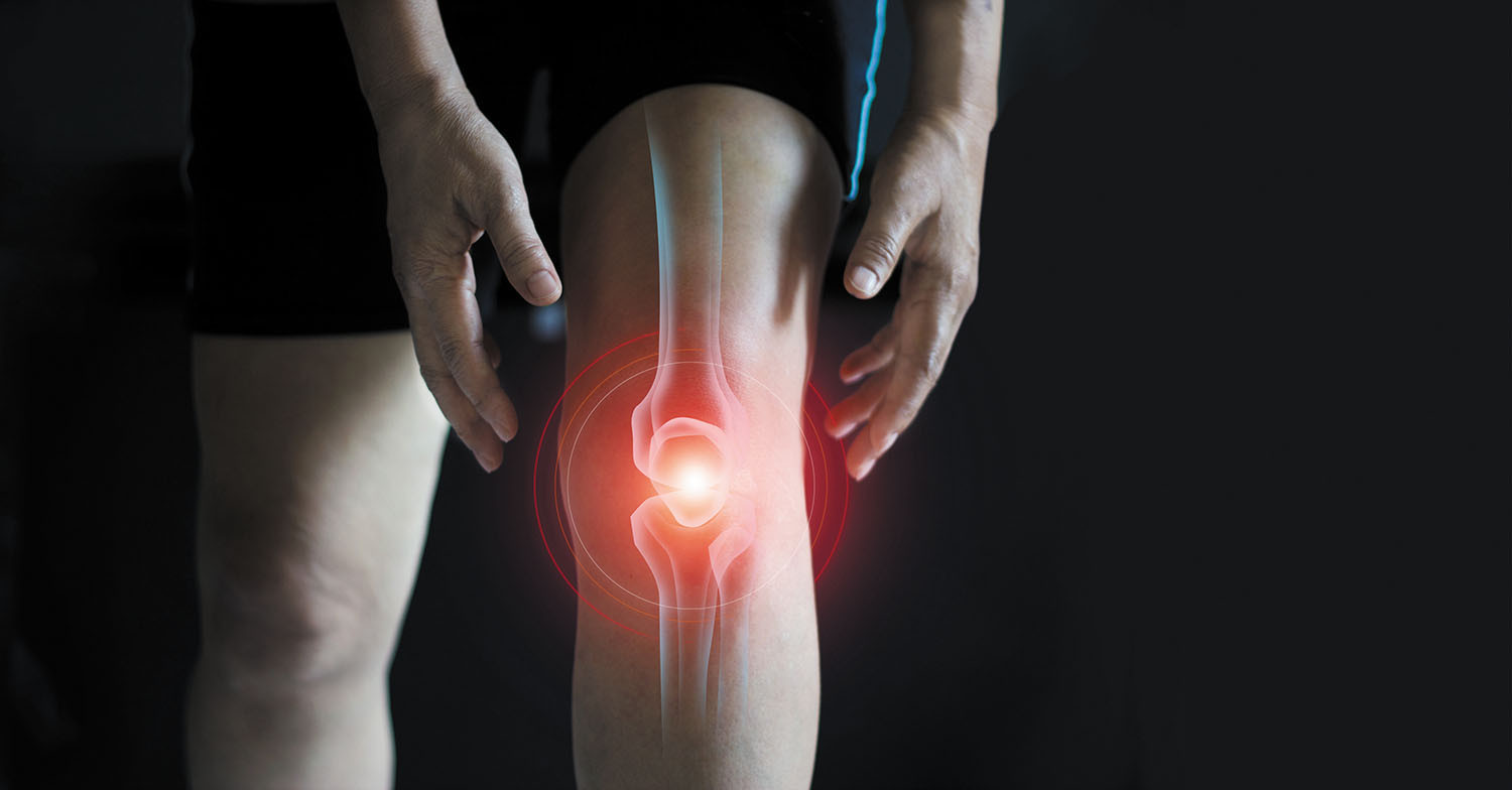 Dealing with Psoriatic Knee Arthritis and Bone-on-Bone Knee Pain: Your Friendly Guide